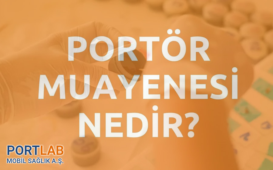 Mobil Portör Testi Nedir